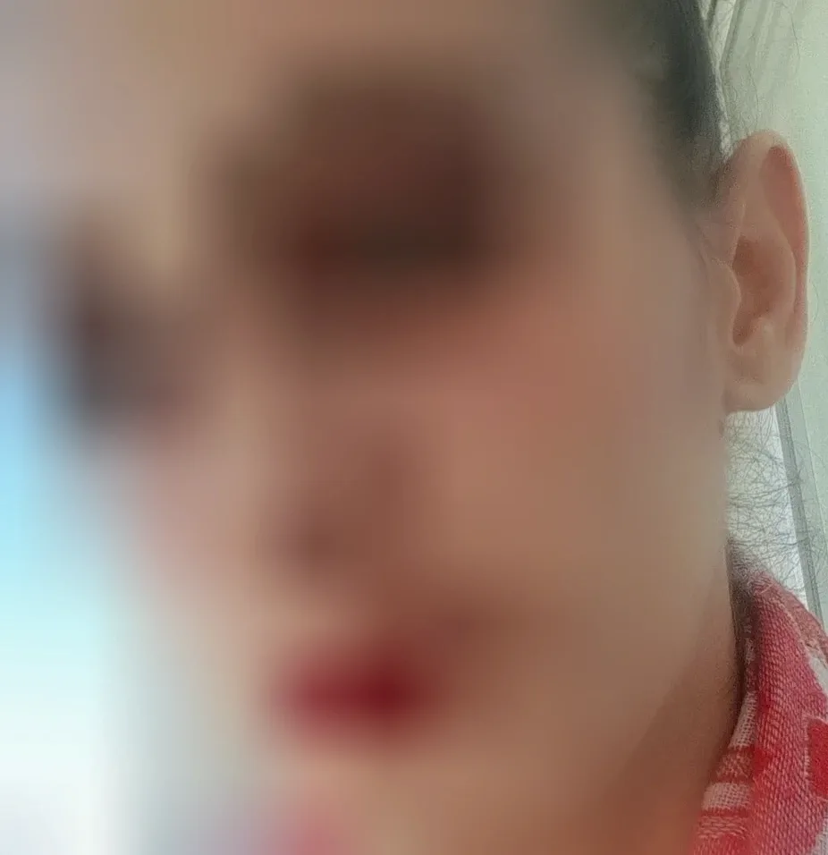Renske, 37